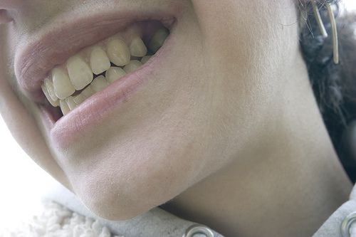 Kas notiek tavā mutē jeb Interesanti par zobiem